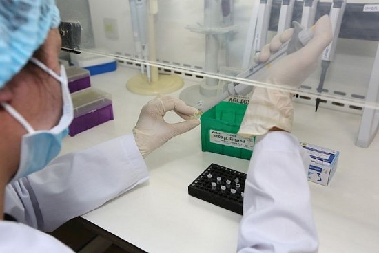 TP. Hồ Chí Minh: Thanh tra, kiểm tra việc mua sắm kit test ở 3 bệnh viện